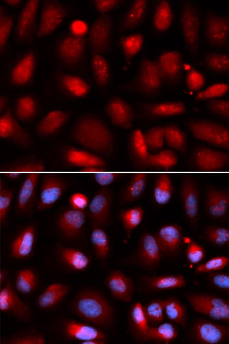 Polyclonal Rabbit anti-Human RELA / NFKB p65 Antibody (IHC, IF, WB)