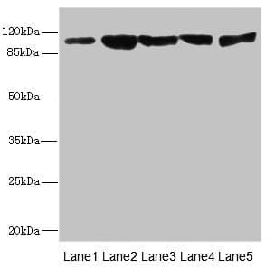 DSC2 / Desmocollin 2 Antibody
