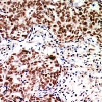 TEAD3 Antibody