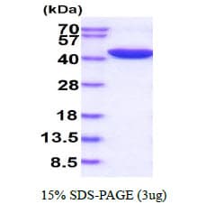 Human SERPINE1 / PAI-1 Protein (Recombinant His)