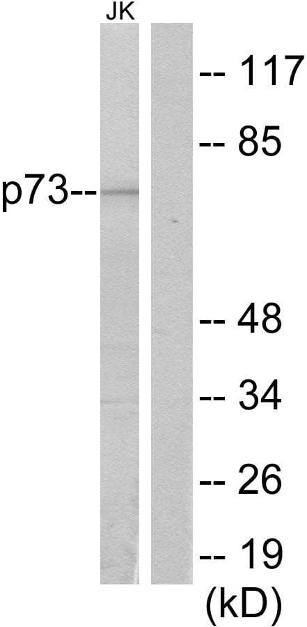 TP73 / p73 Antibody