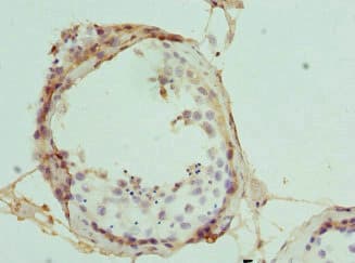 Polyclonal Rabbit anti-Human CPSF3L Antibody (IHC, WB)