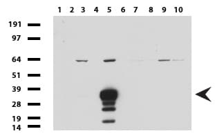 SYP / Synaptophysin Antibody (clone UMAB112)