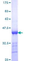 Human CENPE Protein (Recombinant GST, N-terminus)