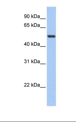 GSR / Glutathione Reductase Antibody (aa182-231)