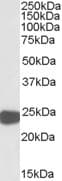 IHC-plus™ PRDX1 / Peroxiredoxin 1 Antibody (aa106-117)