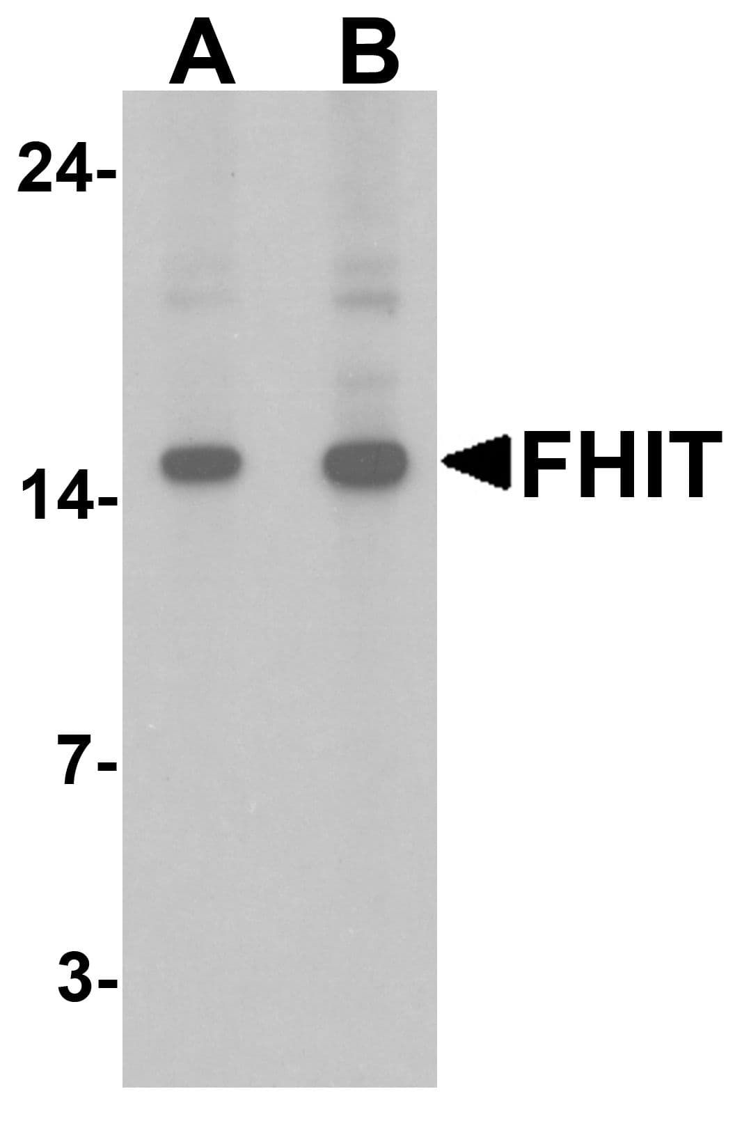 IHC-plus™ FHIT Antibody