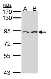 CLLP / CTNNAL1 Antibody (aa292-563)