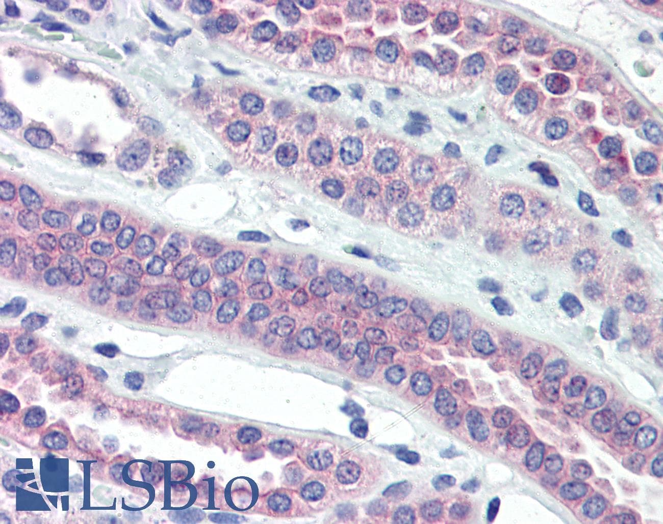 IHC-plus™ Polyclonal Rabbit anti-Human TJP3 / ZO3 Antibody (C-Terminus, IHC, IF, WB)