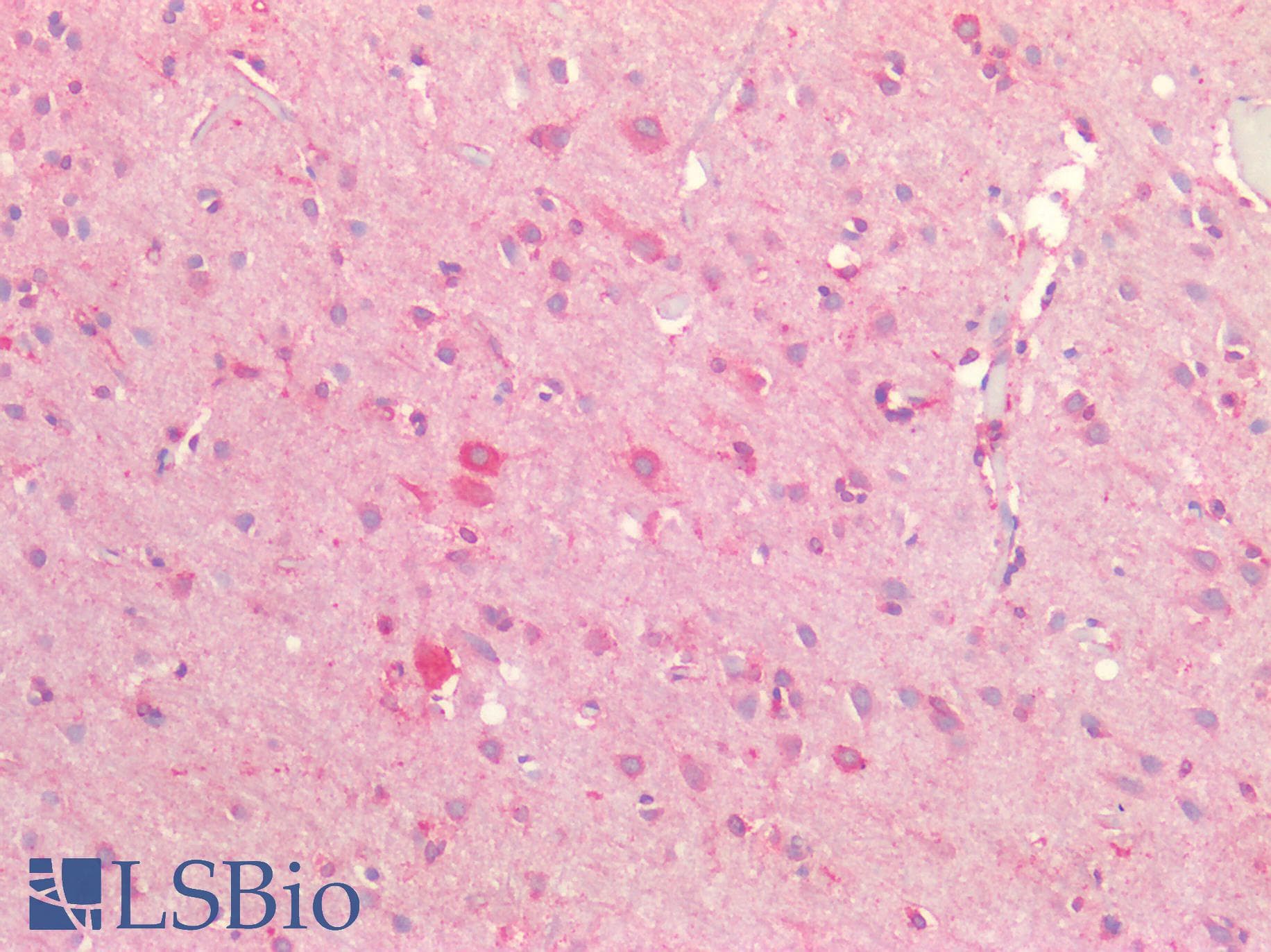 IHC-plus™ ZFP91 Antibody