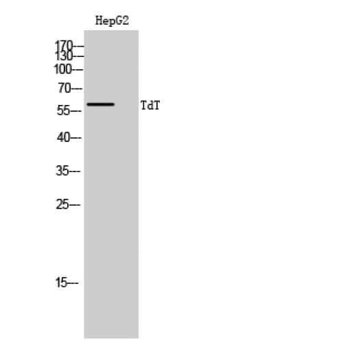 DNTT / TdT Antibody (350-430 aa, Internal)