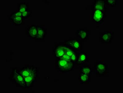 Polyclonal Rabbit anti-Human TSR2 Antibody (IHC, IF, WB)