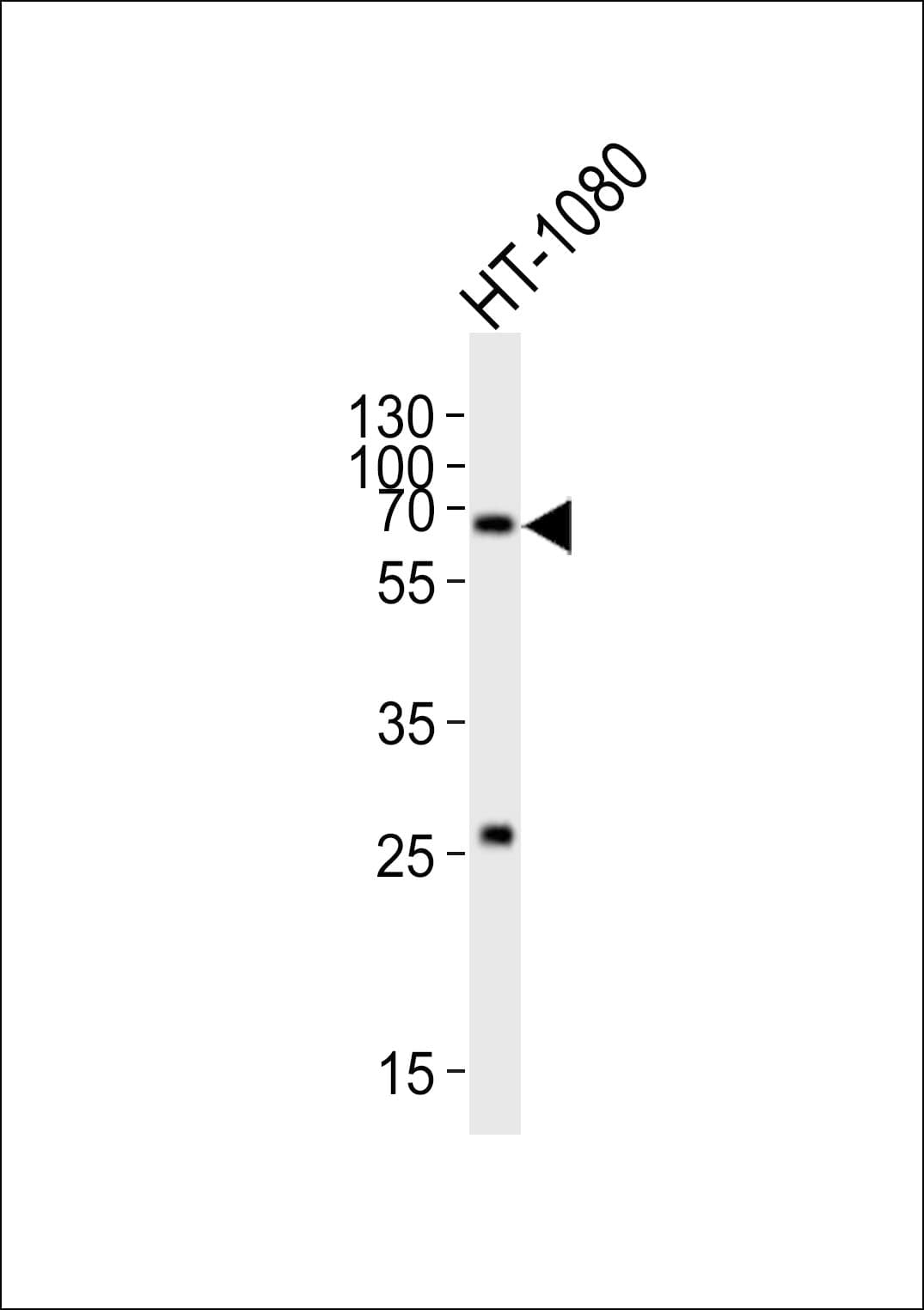 Polyclonal Rabbit anti-Human SMAD1 Antibody (aa257-290, WB)