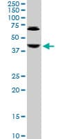 IHC-plus™ ABHD5 Antibody (clone 1F3)