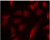 GATA1 Antibody (phospho-Ser310)