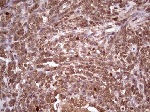 Monoclonal Mouse anti-Human CDKL2 Antibody (clone OTI12C2, aa291-493, IHC, WB)