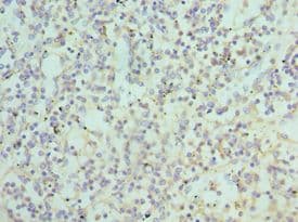Polyclonal Rabbit anti-Human ATG16L1 / ATG16L Antibody (aa90-300, IHC, WB)