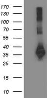 SIRT5 / Sirtuin 5 Antibody (clone OTI2F1)