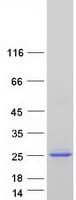Human UBCH10 / UBE2C Protein (Recombinant Myc-DDK (Flag))