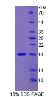 Rabbit CCL2 / MCP1 Protein (Recombinant His)