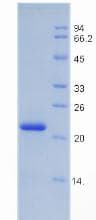 Rat IGFBP3 Protein (Recombinant His)