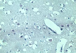 TARBP2 / TRBP2 Antibody (aa340-390)