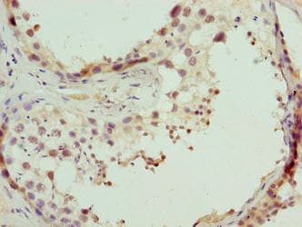 CPXCR1 / CT77 Antibody
