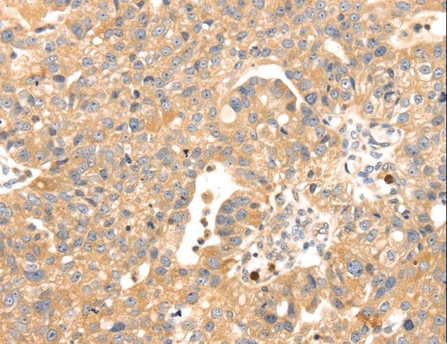 IHC-plus™ S100A12 Antibody