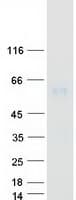 Human UGT1A4 Protein (Recombinant Myc-DDK (Flag))
