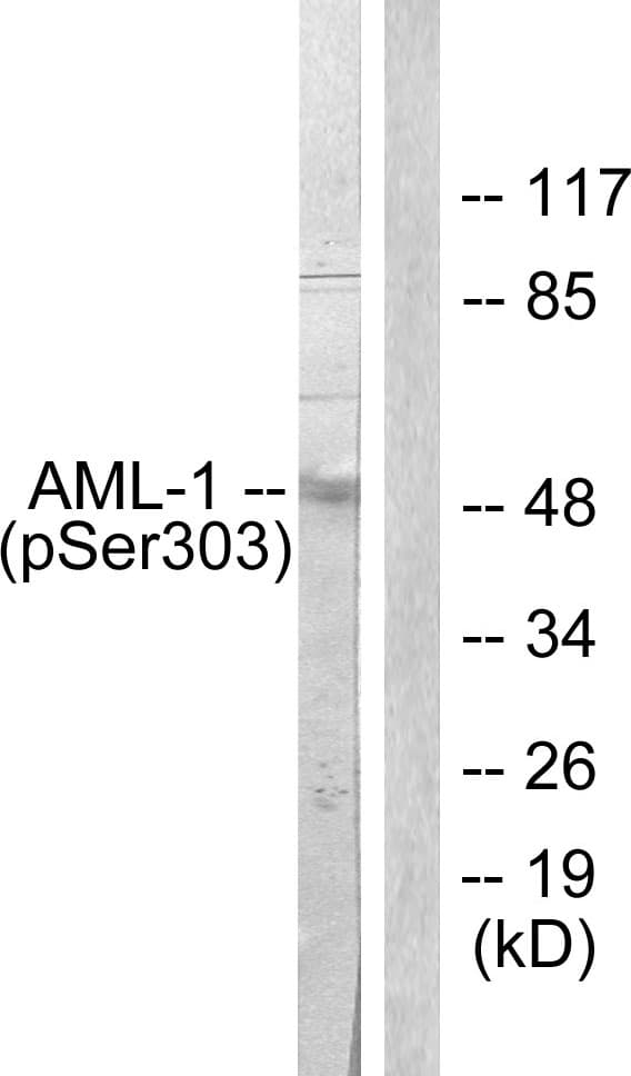 AML1 / RUNX1 Antibody (phospho-Ser303)