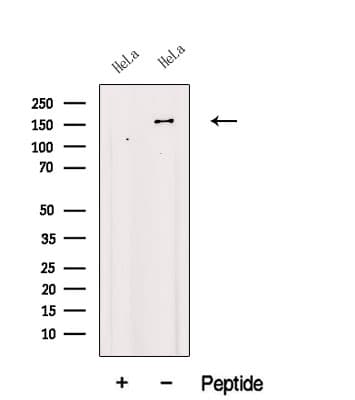 Polyclonal Rabbit anti-Human KDM2B / FBXL10 Antibody (WB)