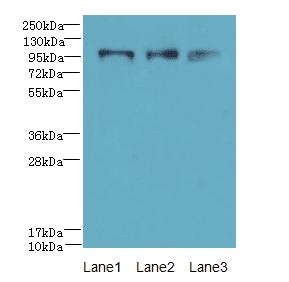 Polyclonal Rabbit anti-Human HKDC1 Antibody (IHC, WB)