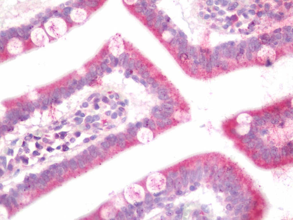 IHC-plus™ Polyclonal Rabbit anti-Human SLC29A4 Antibody (IHC, IF, WB)