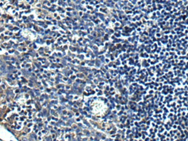 PRRT2 Antibody