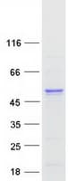 Human TXNDC5 / ERP46 Protein (Recombinant Myc-DDK (Flag))