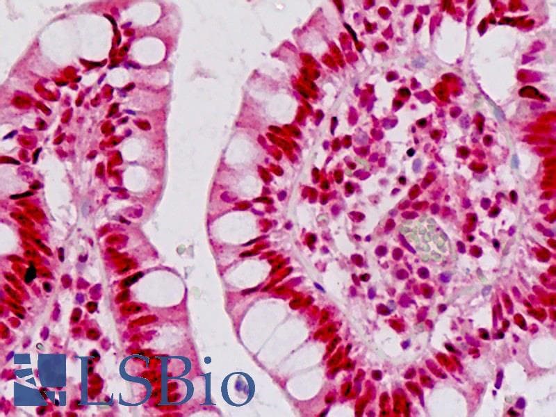 IHC-plus™ Polyclonal Rabbit anti-Human EN1 / Engrailed Antibody (aa1-30, IHC, IF, WB)