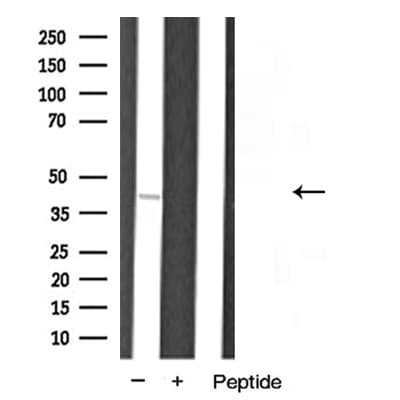 HNRPA1 / HnRNP A1 Antibody