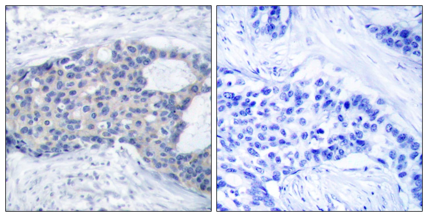 ZAP70 Antibody (phospho-Tyr493)