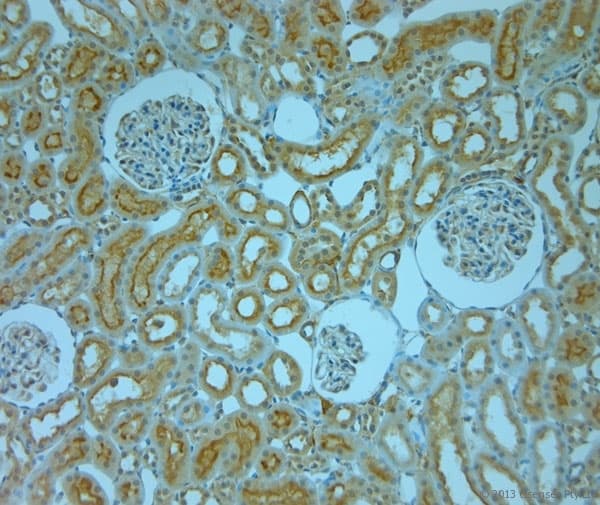 SLC6A8 Antibody (aa580-630)
