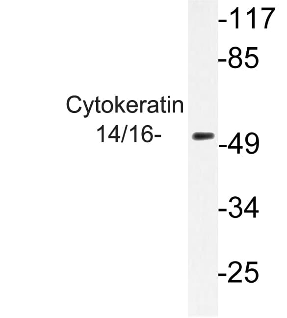 KRT14/KRT16 Antibody (Ser5)