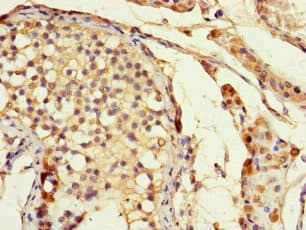 DLX5 Antibody