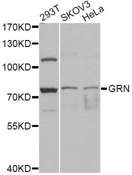 Polyclonal Rabbit anti-Human GRN / Granulin Antibody (IHC, WB)