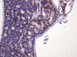 CA12 / Carbonic Anhydrase XII Antibody (clone OTI4G3)