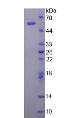 Human CELA3A / ELA3 Protein (Recombinant His-GST, N-terminus)