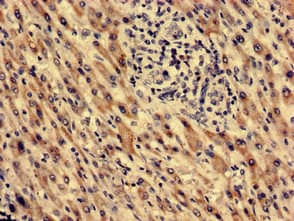 Polyclonal Rabbit anti-Human MECR Antibody (aa211-373)