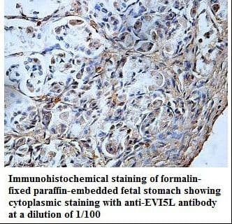 Polyclonal Rabbit anti-Human EVI5L Antibody (aa642-794, IHC, WB)