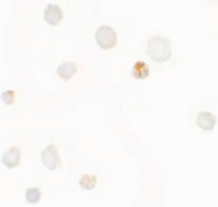 IHC-plus™ Polyclonal Rabbit anti-Human SEPT1 / Septin 1 Antibody (IHC, IF, WB)