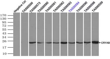 CRYAB / Alpha B Crystallin Antibody (clone OTI5C9)
