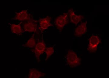ADCY1 / Adenylate Cyclase 1 Antibody