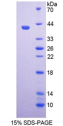 Human PAX9 Protein (Recombinant His-T7)